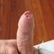 uncut cock